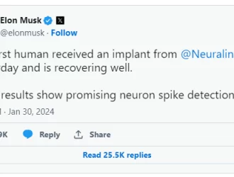 What is the Neuralink Brain Implant